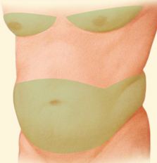 Liposuction abdomen utah