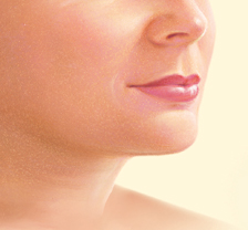 after liposuction of the chin