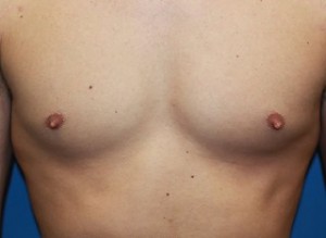 nipple pre