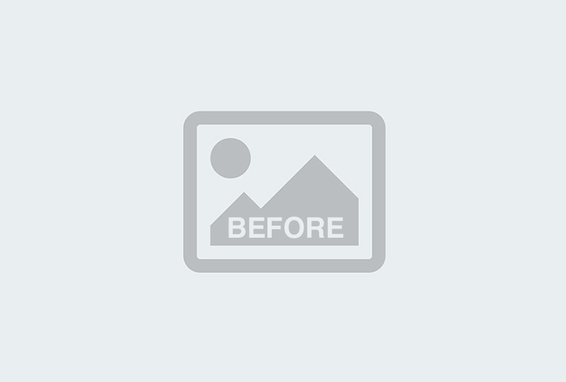 Before Image: Patient 44009 - right-front-oblique