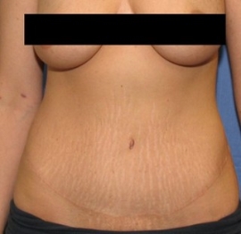 After Image