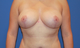 After Image