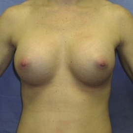 After Image
