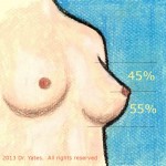 Natural-breast-art Perfect Shaped Breast Augmentation Salt Lake City