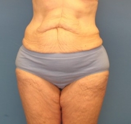 Before Image