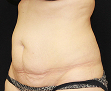 After Image