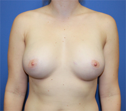 After Image