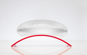Saline implant