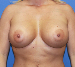 After Image