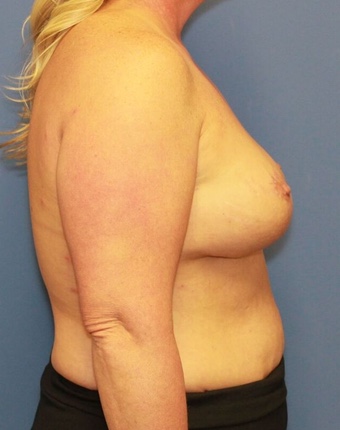 After Image