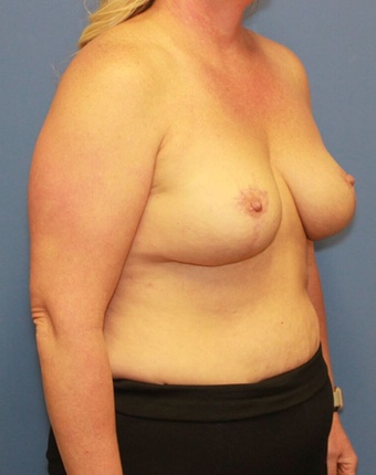 After Image