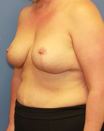 After Image