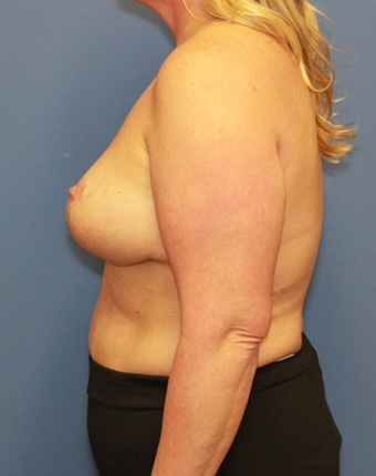 After Image