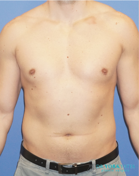 After Image