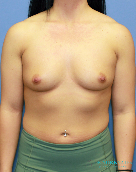 Before Image
