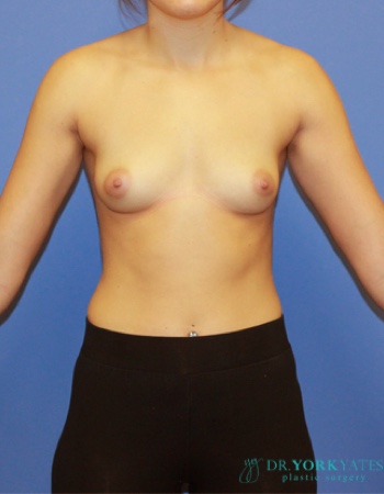 Before Image