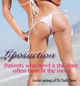 Liposuction banner