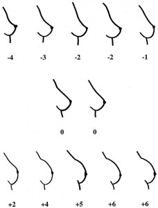 breast shape study 228x300 1
