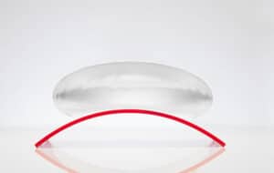 Saline implant