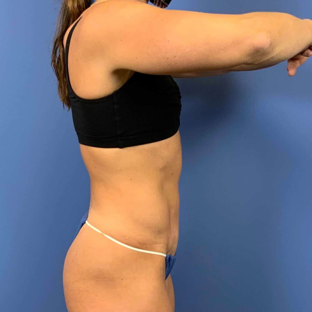After Image: Patient 43384 - right-side