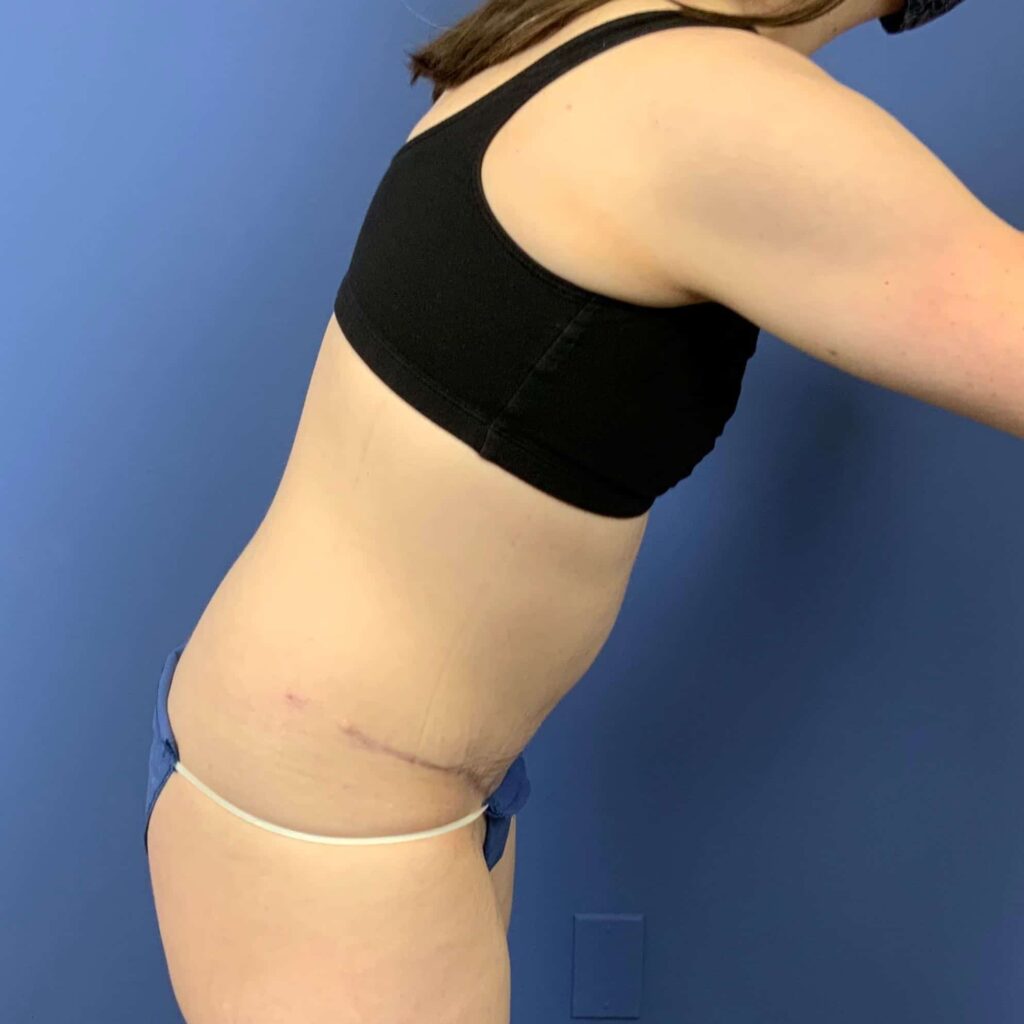 After Image: Patient 43431 - right-side