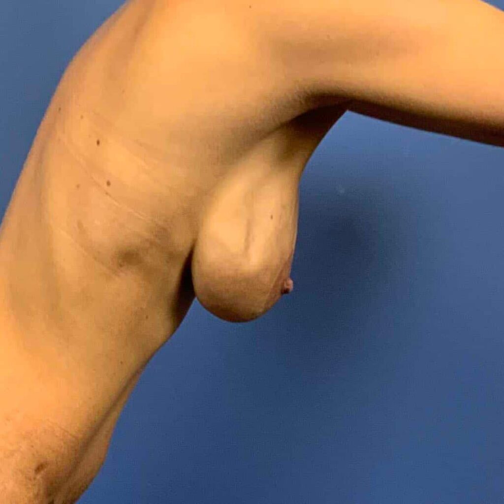 Before Image: Patient 43538 - other