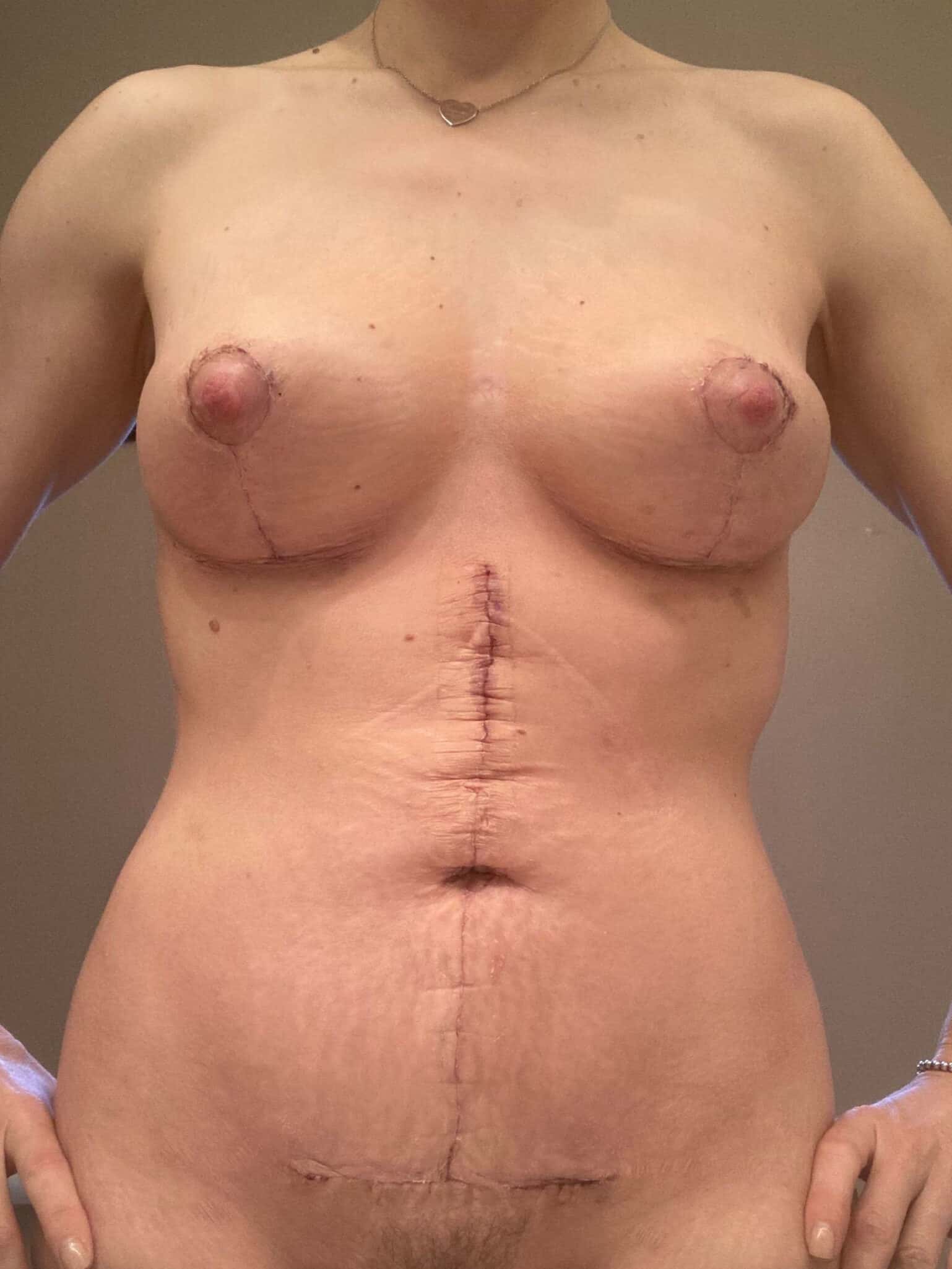 After Image: Patient 43986 - front