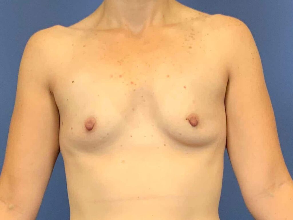 Before Image: Patient 43973 - front