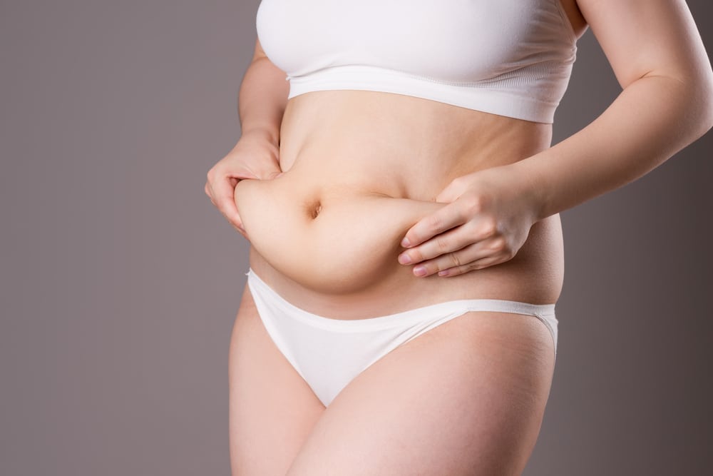 Tummy tuck, flabby skin on a fat belly, plastic surgery concept