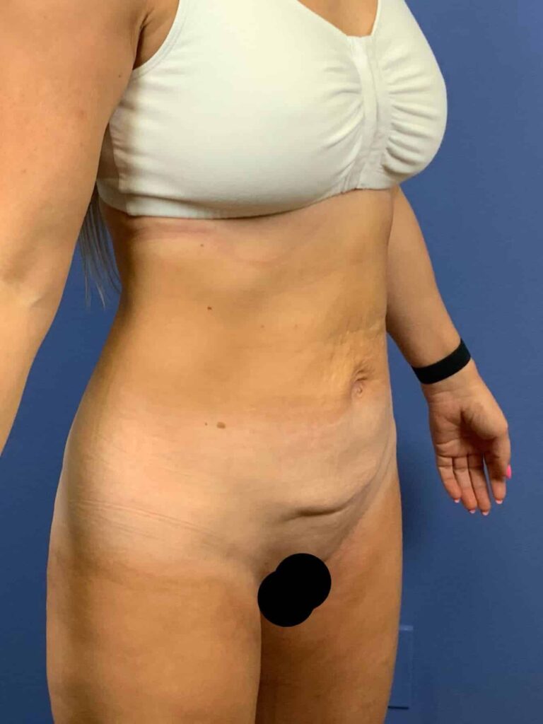 Before Image:  - right-front-oblique