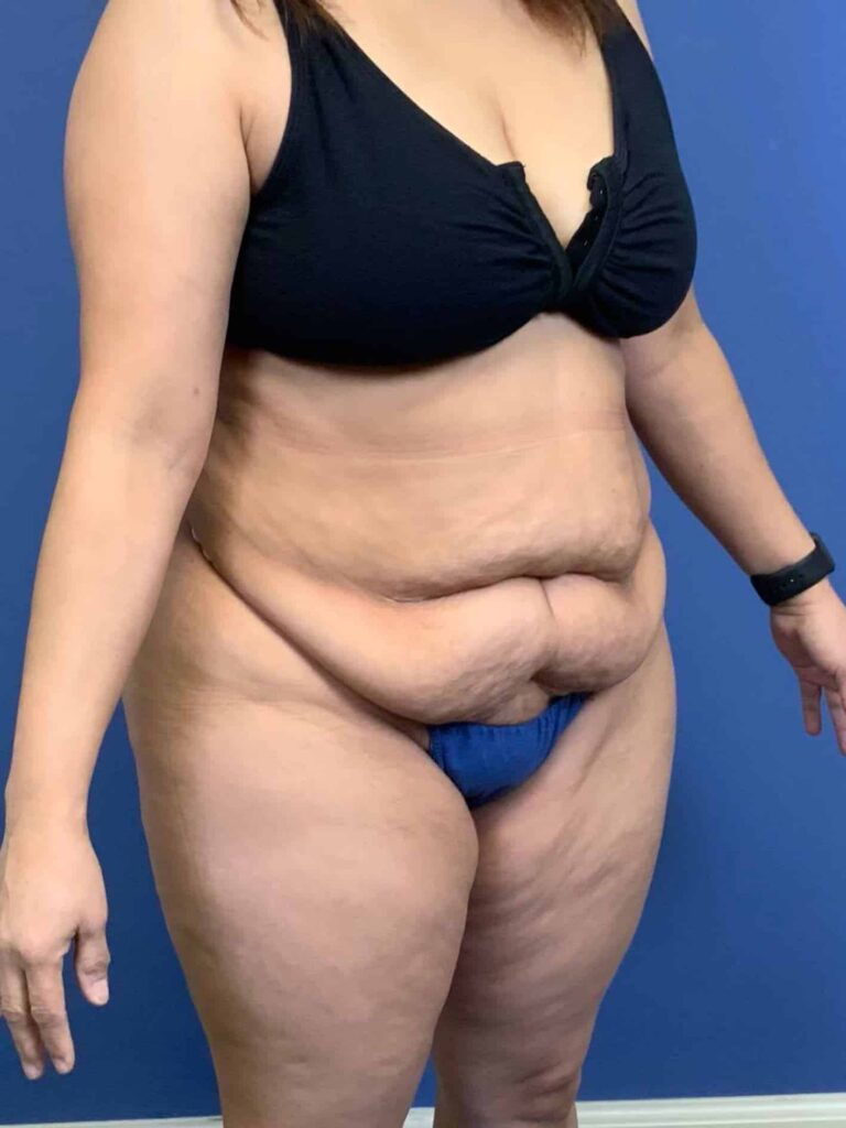 Before Image:  - right-front-oblique