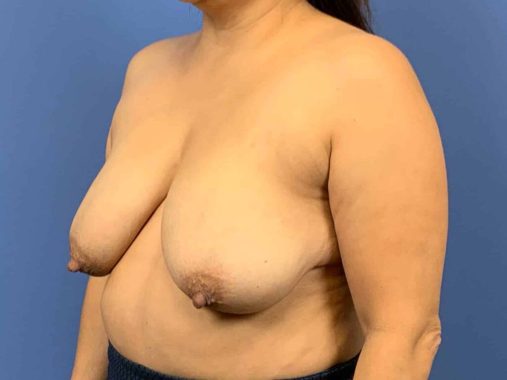Before Image:  - left-front-oblique