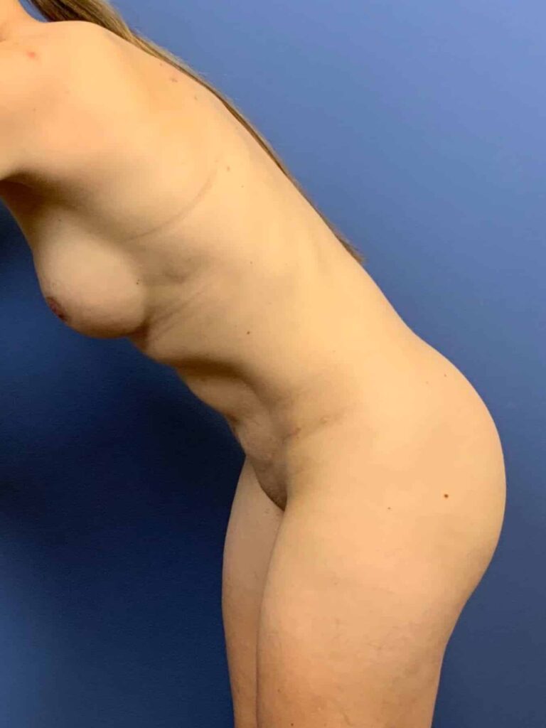 After Image:  - other