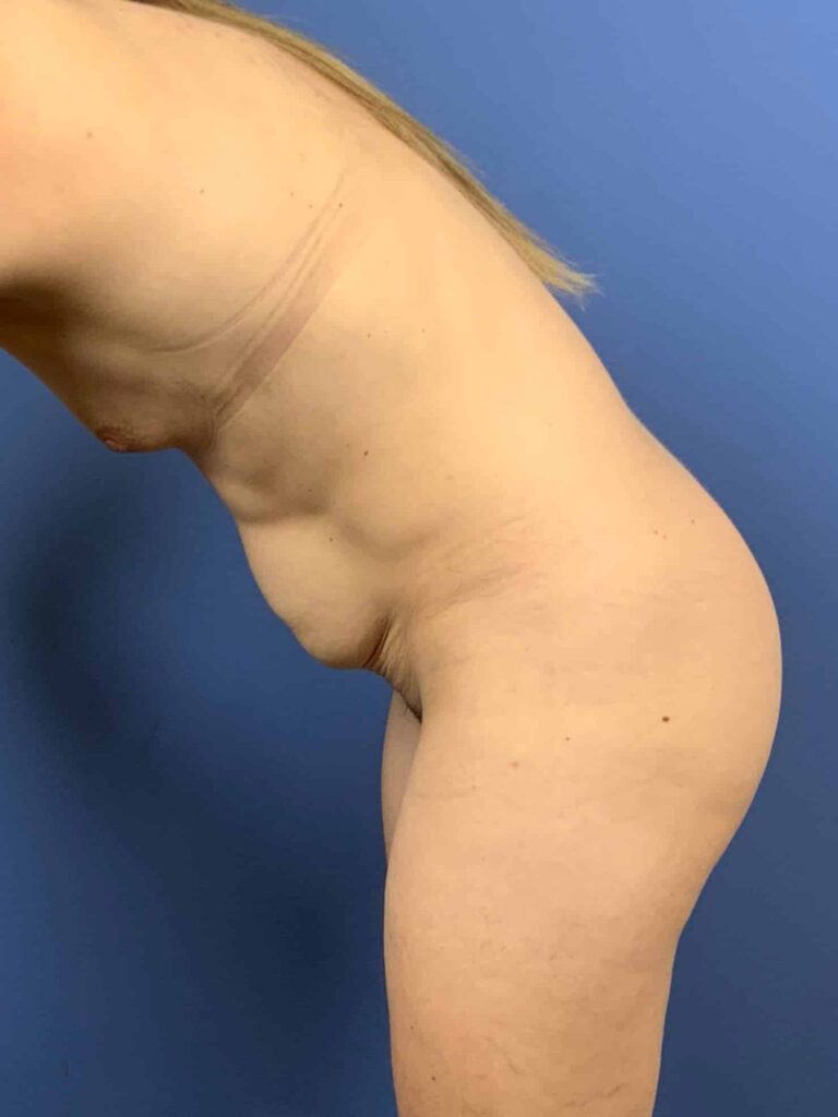 Before Image:  - other