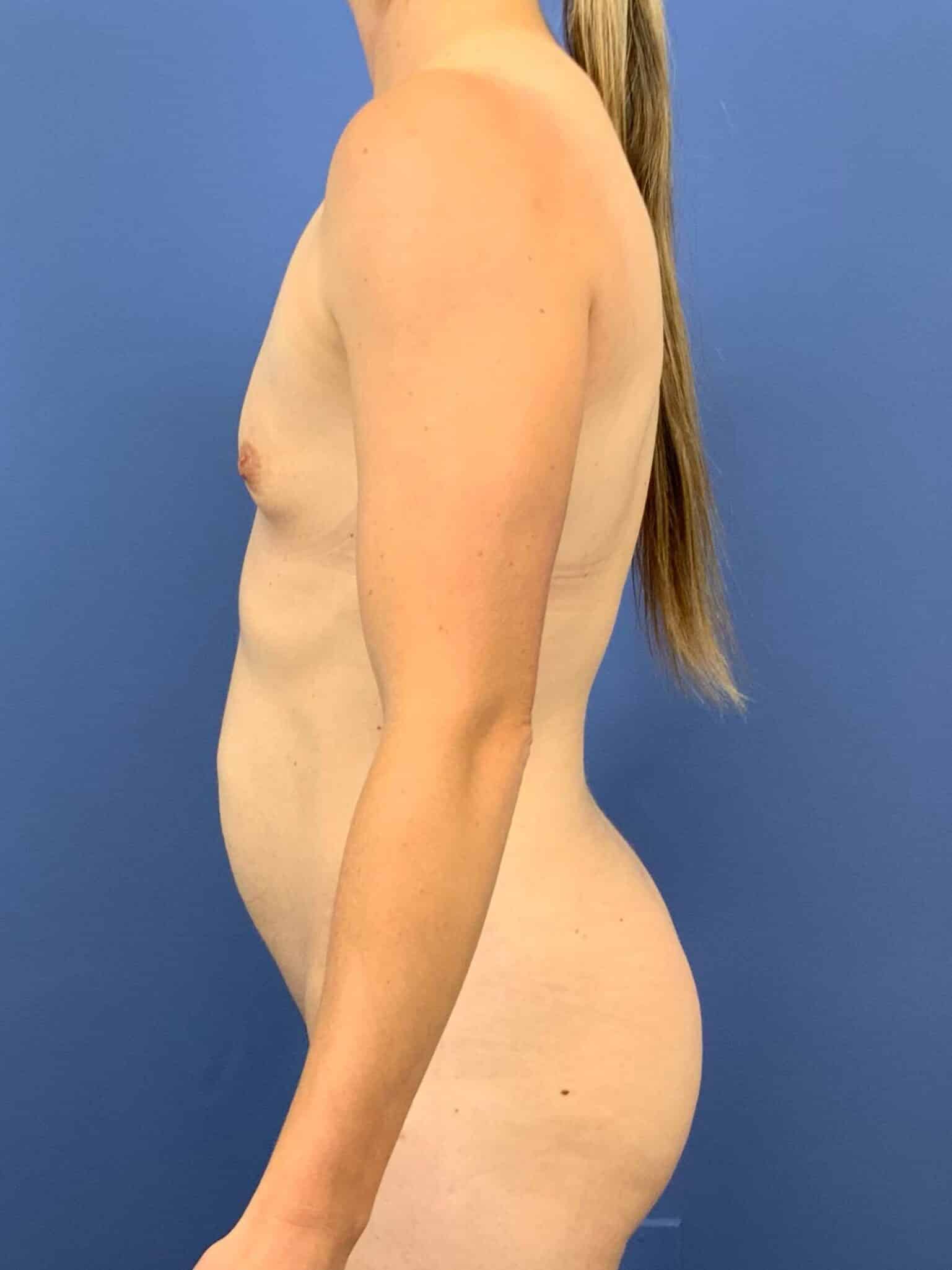 Before Image:  - left-side