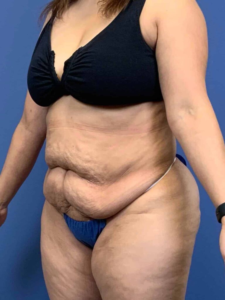 Before Image:  - left-front-oblique