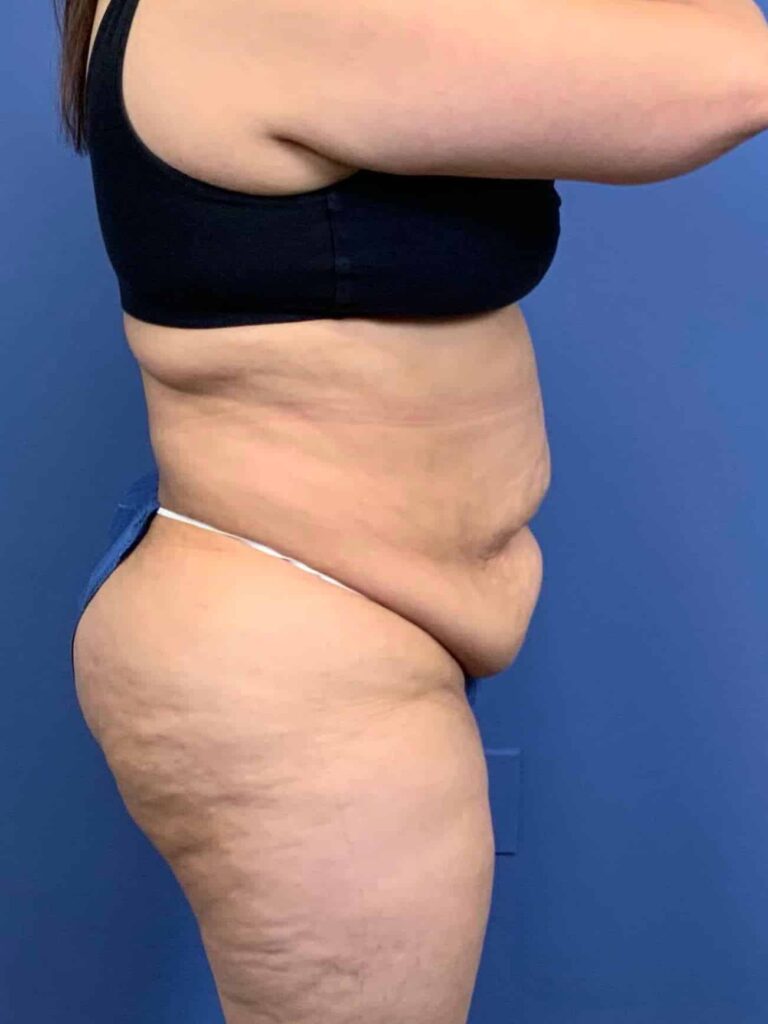 Before Image:  - right-side