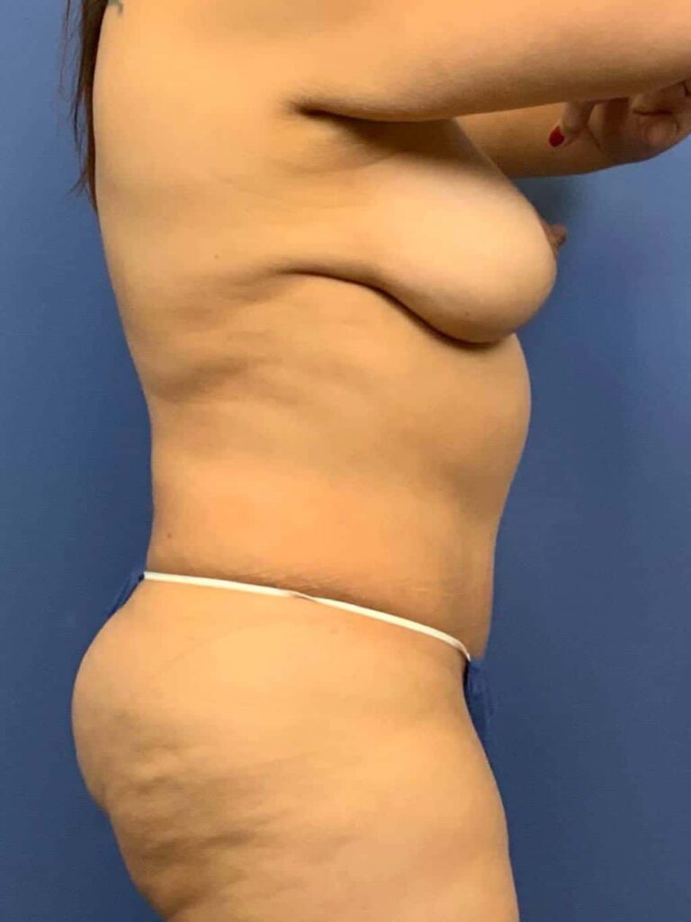 After Image:  - right-side