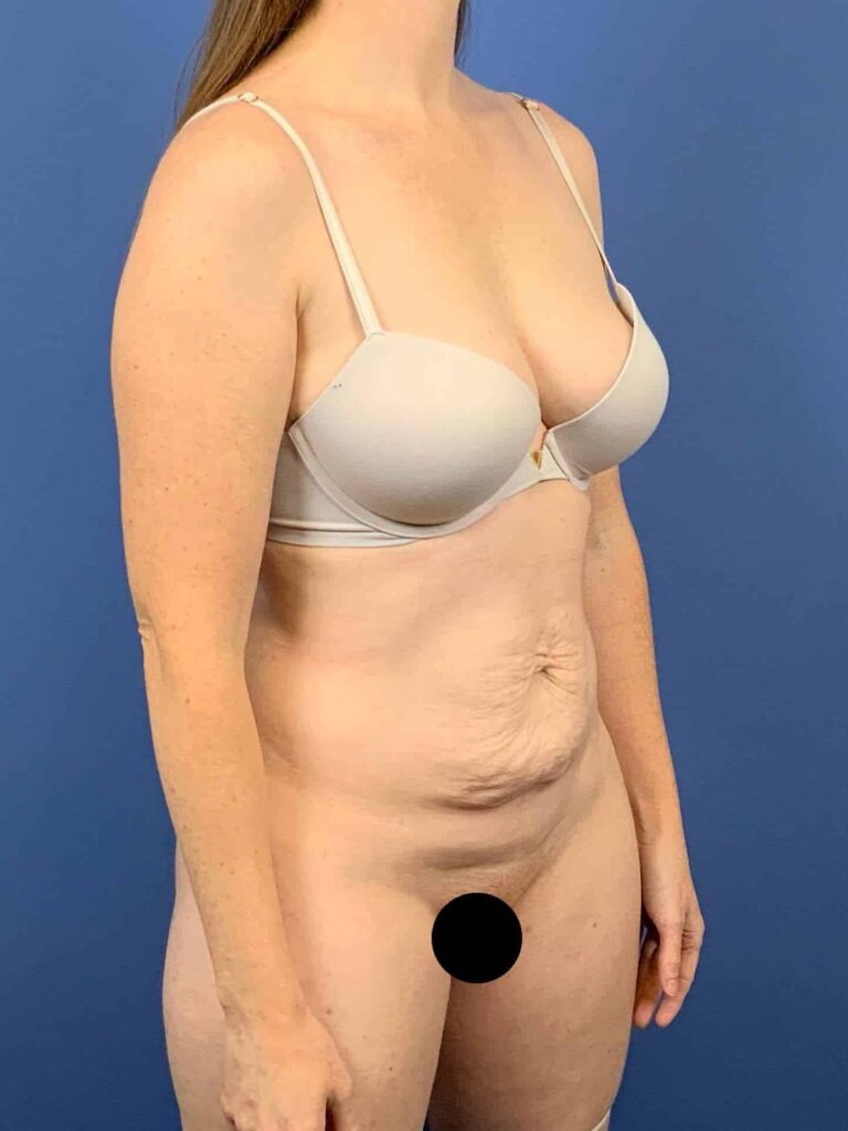 Before Image:  - right-front-oblique