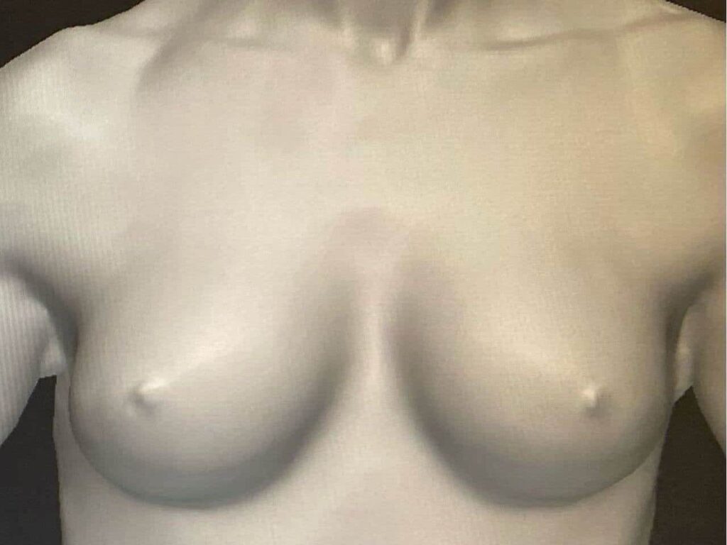 Before Image:  - other