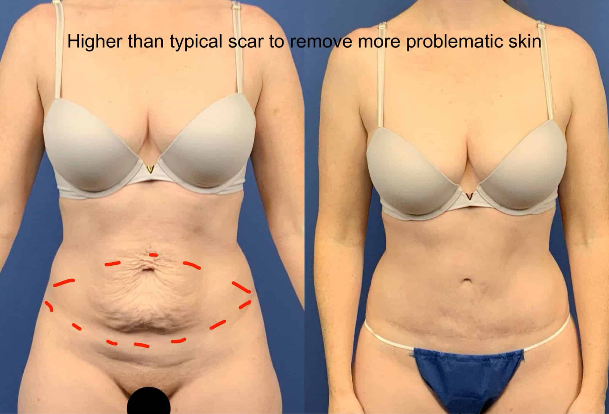 After Image:  - other