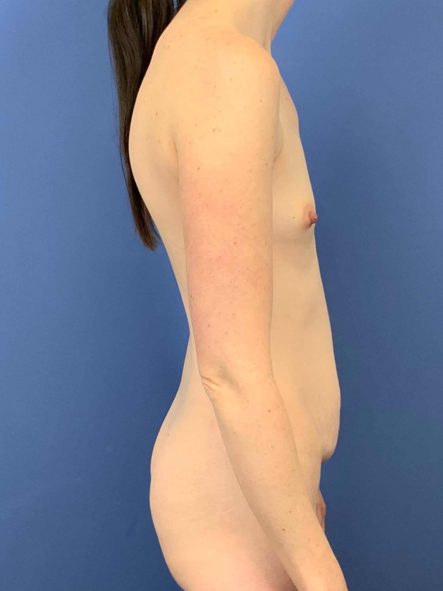 Before Image:  - front