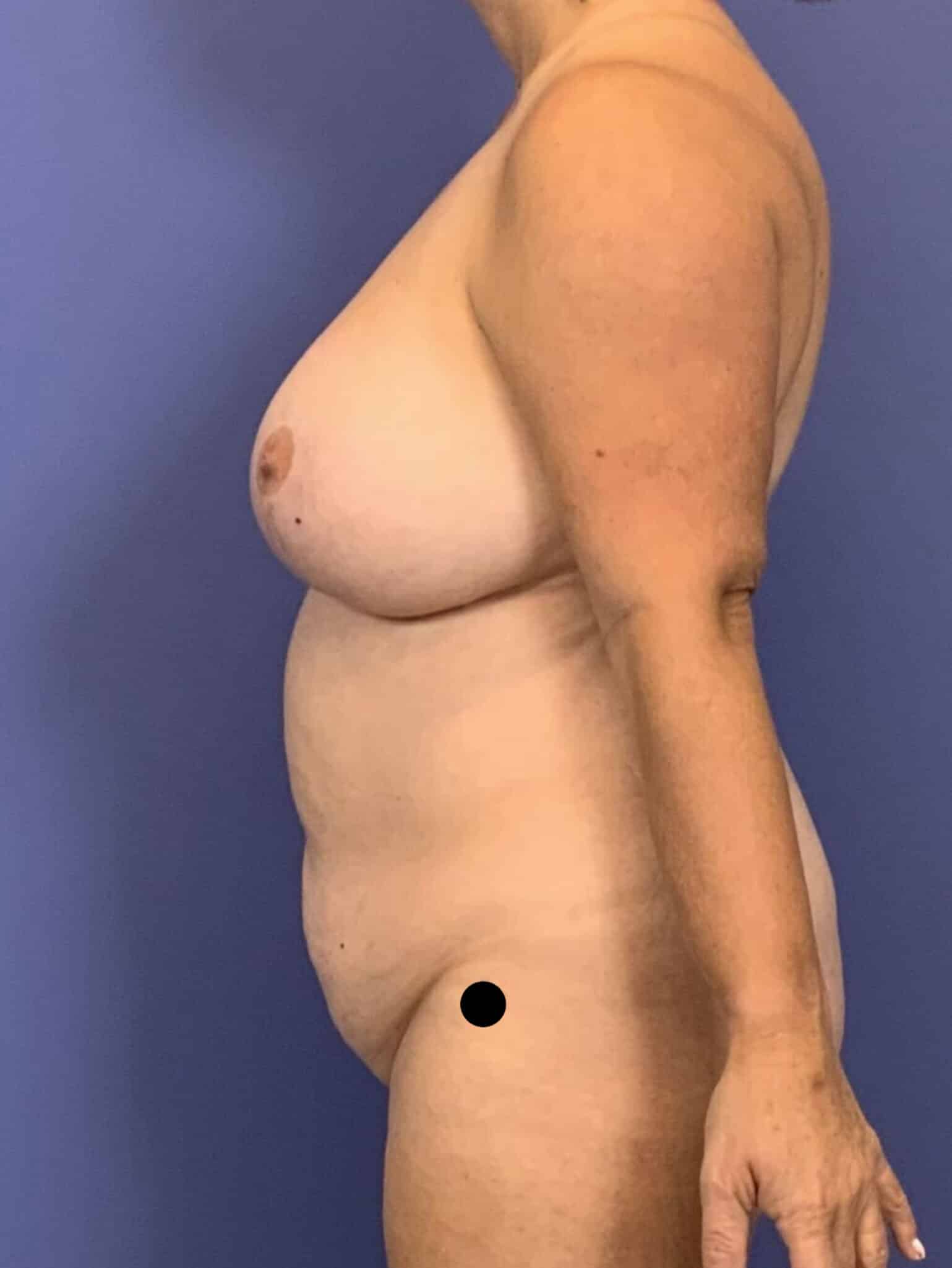 Before Image:  - left-side