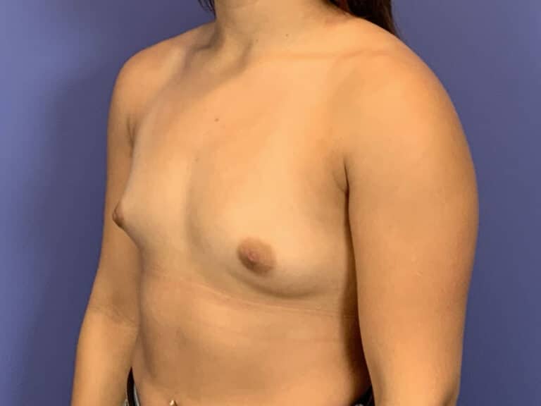 Before Image:  - left-front-oblique