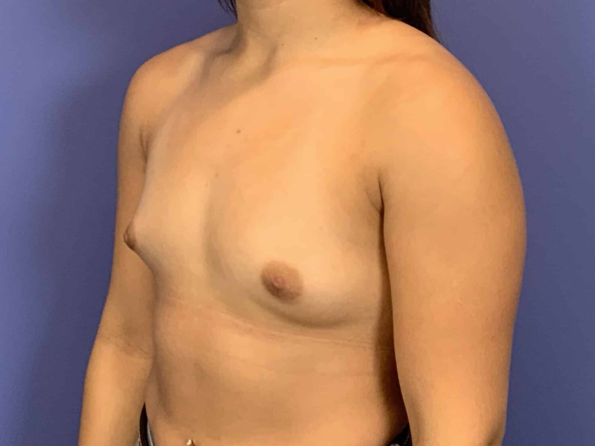Before Image:  - left-front-oblique
