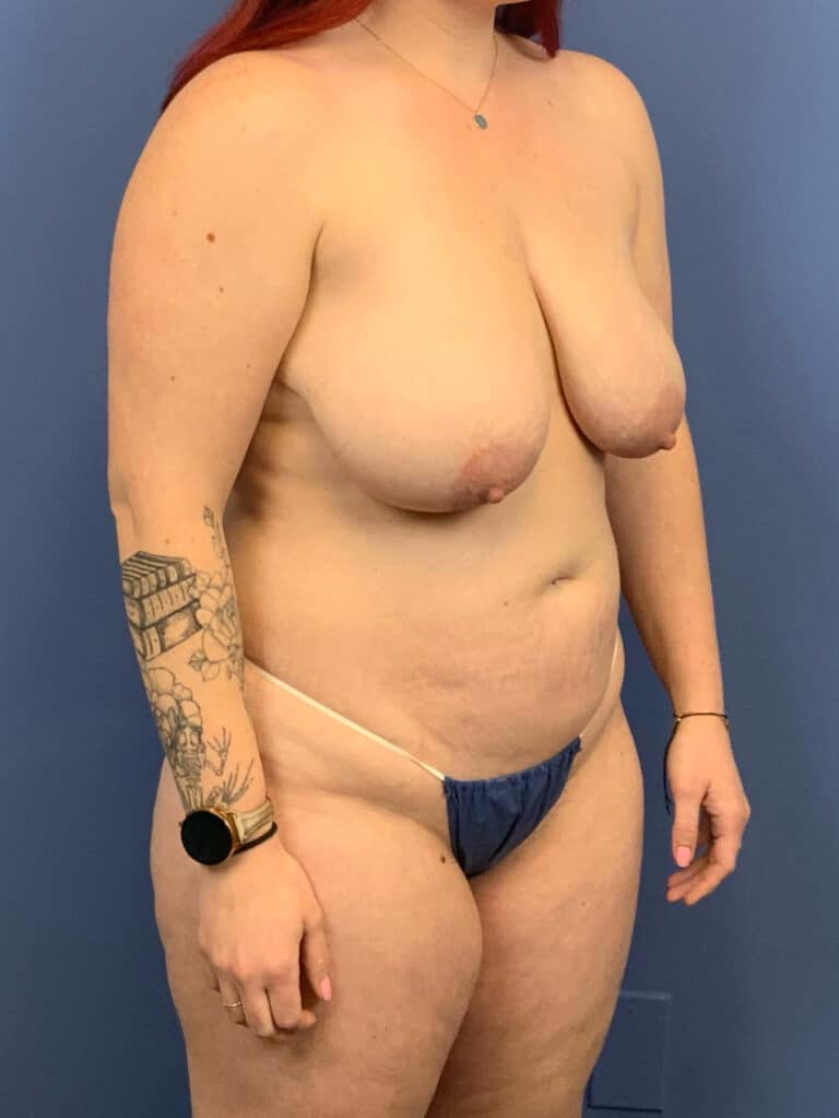 Before Image:  - right-front-oblique