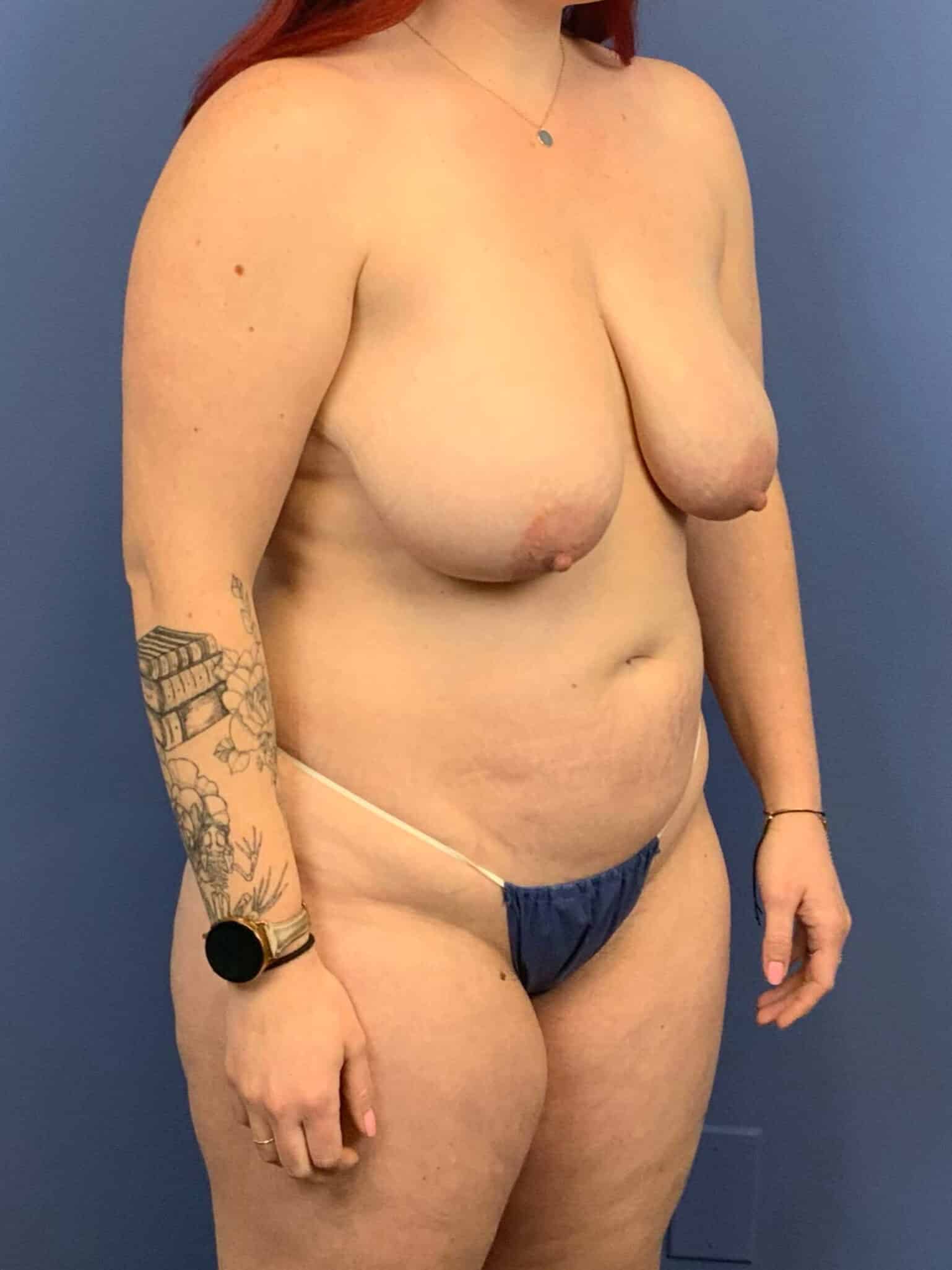 Before Image:  - right-front-oblique
