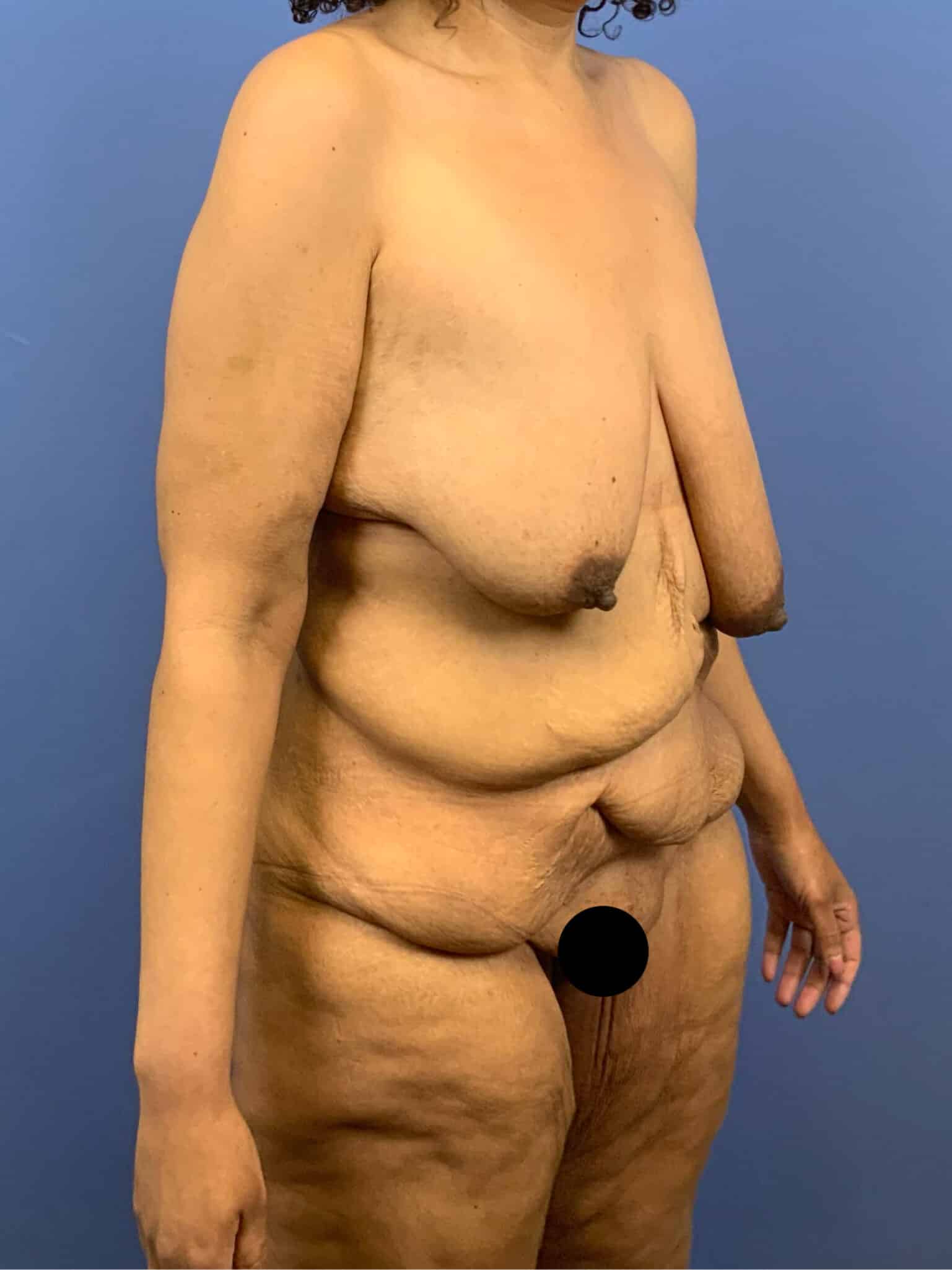 Before Image:  - right-front-oblique