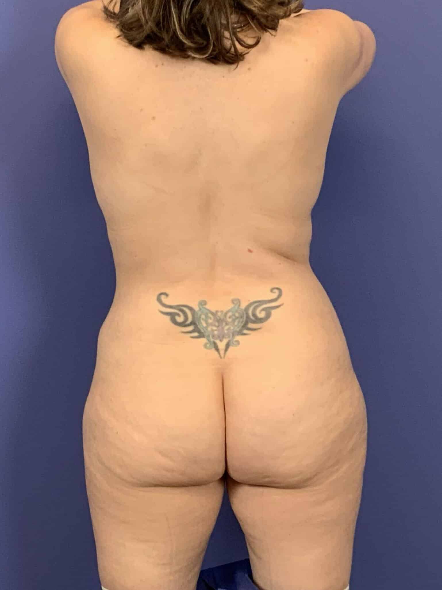 After Image:  - back