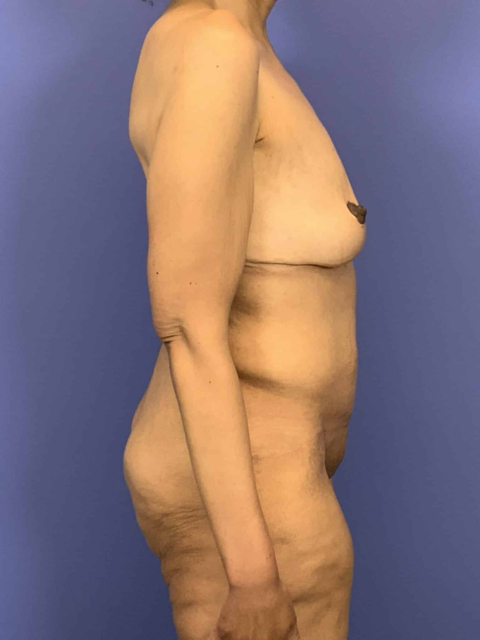 After Image:  - right-side